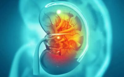 How to Check Your Kidney Treatment Works or not