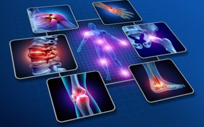Rheumatoid Arthritis Remission: An Evidence-Based Approach with Natural Medicine and Anti-Inflammatory Diet