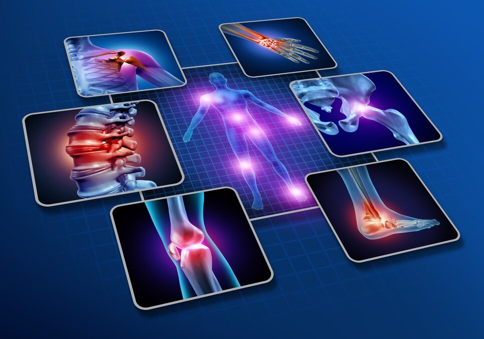 Rheumatoid Arthritis Remission: An Evidence-Based Approach with Natural Medicine and Anti-Inflammatory Diet